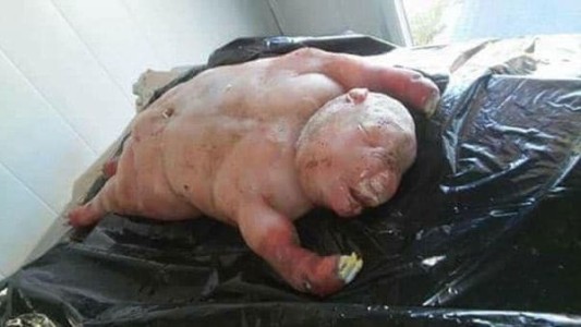 Pánico y misterio en Sudáfrica por el nacimiento de un "cordero-hombre"