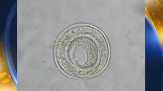 Alerta en Estados Unidos por un parásito letal que ataca el cerebro humano