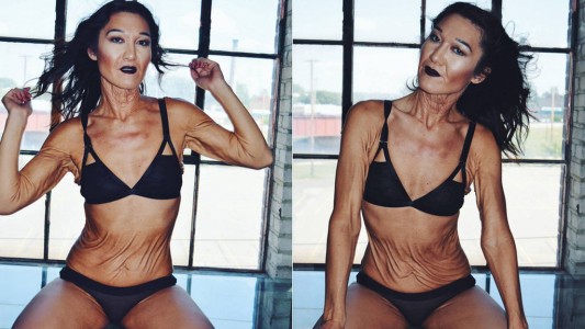 El extraño caso de la modelo de 26 años que parece una anciana por una enfermedad