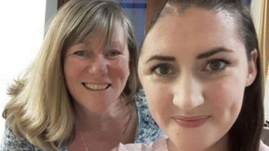 La increíble recuperación de la modelo que perdió un tercio del cráneo