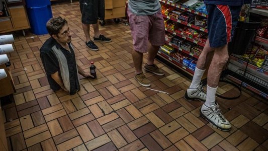 La increíble historia del hombre que tiene medio cuerpo y vive como estrella de rock