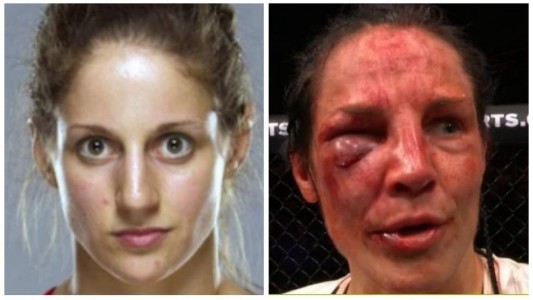 "Me siento un poco culpable por cómo quedó": brutal combate de UFC