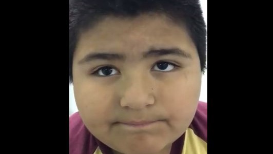 El nene que se tragó un silbato y emite un extraño sonido cada vez que abre la boca