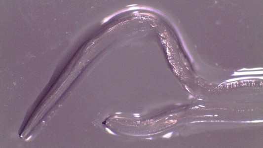 Estados Unidos: extrajeron 14 gusanos del ojo de una mujer