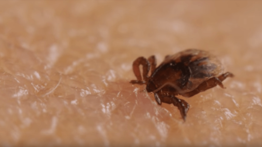 Video escalofriante: así escarba una garrapata en la piel humana