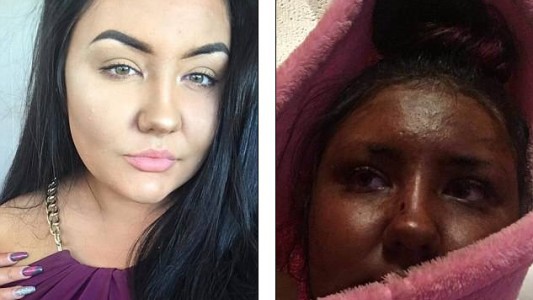 Se puso autobronceador, quedó verde como Fiona de Shrek y es viral