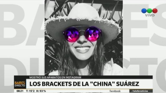 Los brackets de "La China" Suárez