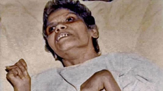 Murió una enfermera que estuvo 42 años en coma tras ser violada