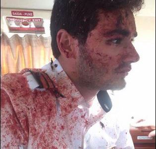 Video: Una avioneta chocó contra un buitre en pleno vuelo