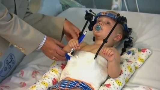 Médicos lograron unir la cabeza de un bebé a su cuerpo, tras un accidente