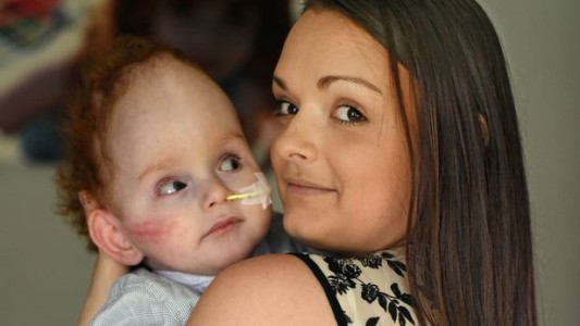 "Mamá": la primera palabra del nene que nació sin cerebro