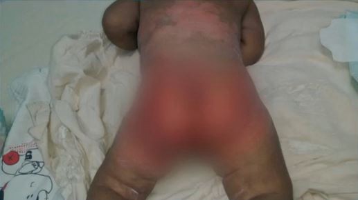 Padres que torturaban a su bebé fueron detenidos