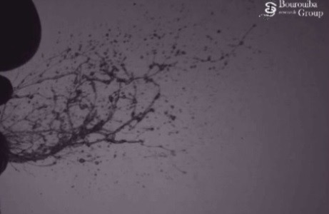 Contuvo un estornudo y se desgarró la garganta