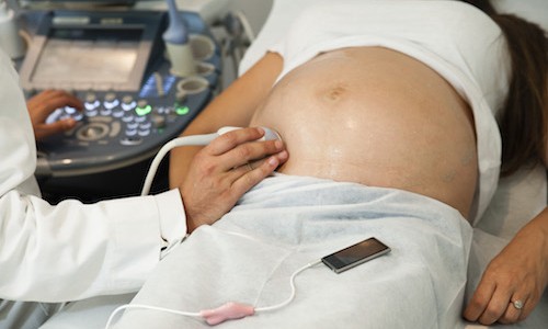 Crean un reproductor de música vaginal para que las embarazadas puedan estimular al bebé