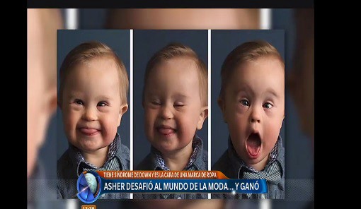 El bebé con Síndrome de Down que es modelo