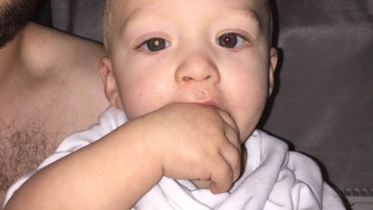 Detectó el tumor que tiene su hijo al ver esta foto