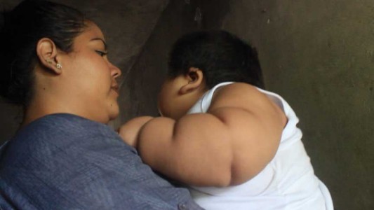 La triste historia de Luisito, el bebé de 10 meses que pesa 30 kilos