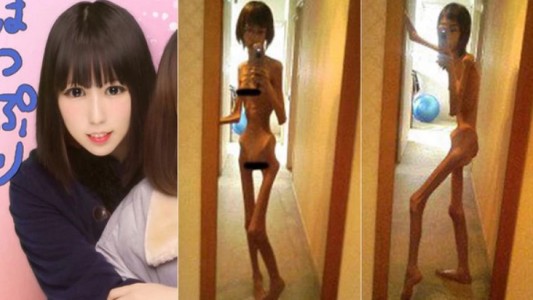 El calvario de la joven japonesa que fue torturada por su abuelo y llegó a pesar 16 kilos
