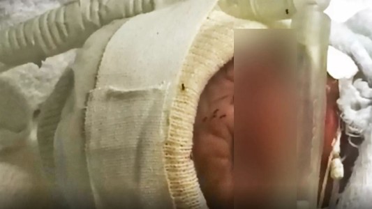 Impactante: grabaron hormigas caminando por la cara de un bebé dentro de una incubadora