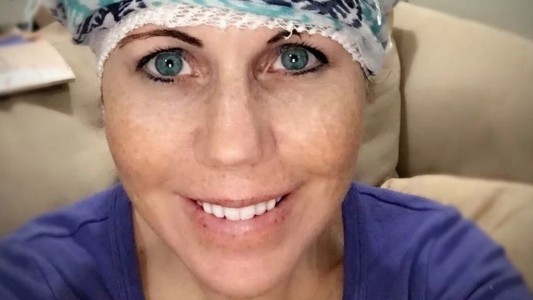 El terrible caso de la mujer que pasó 18 años sin memoria a corto plazo por la reacción alérgica a un antibiótico