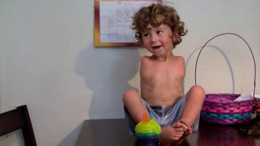 Indignación en Estados Unidos: un restaurante echó a un nene sin brazos por comer con los pies