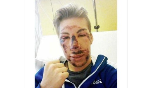 La broma de un esquiador que sufrió un duro accidente