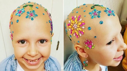 La valentía de esta niña con alopecia que gana un concurso de "peinados raros" se hizo viral