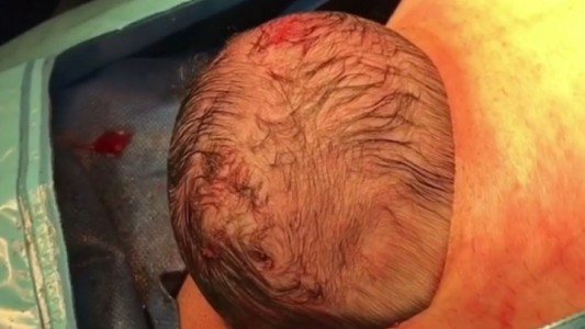 Este video del nacimiento de un bebé gracias a una cesárea "suave" conmueve a las redes sociales