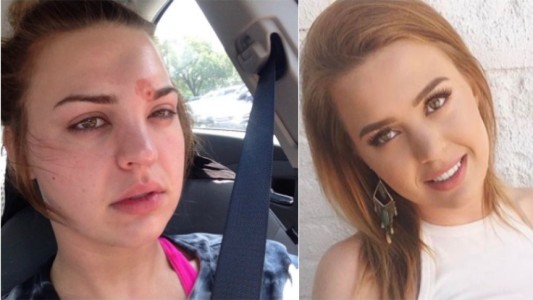 Se explotó un granito y casi termina en tragedia