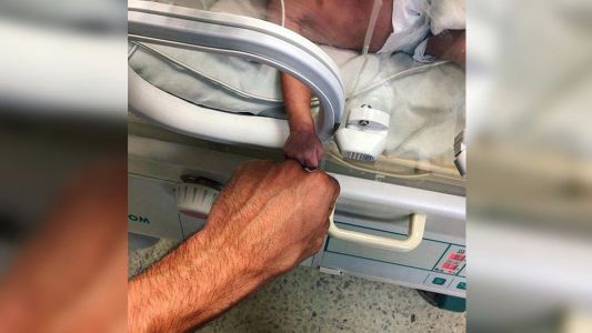 La conmovedora foto de un médico y un bebé que nació prematuro