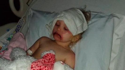 Una nena de tres años tuvo que ser internada después de jugar con el maquillaje que le regaló su madre