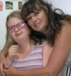 Joven con síndrome de Down necesita un costoso tratamiento para evitar la ceguera