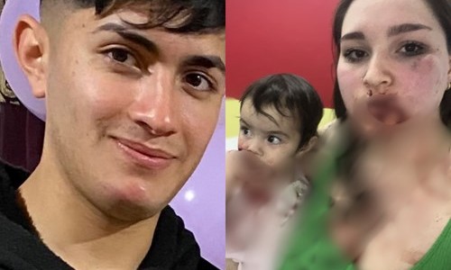 "No sé cómo seguimos vivas": la carta de la joven que fue apuñalada en la cara por su pareja