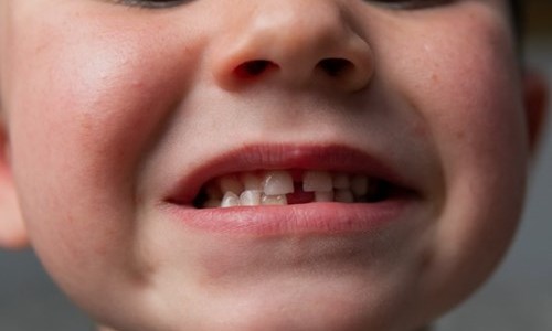 Madre le dio cocaína a su hijo de 4 años por dolor de muelas: 7 años de prisión