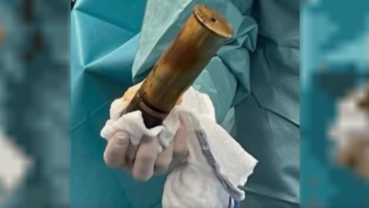 Evacúan hospital en Toulouse por proyectil de la Primera Guerra Mundial alojado en un paciente